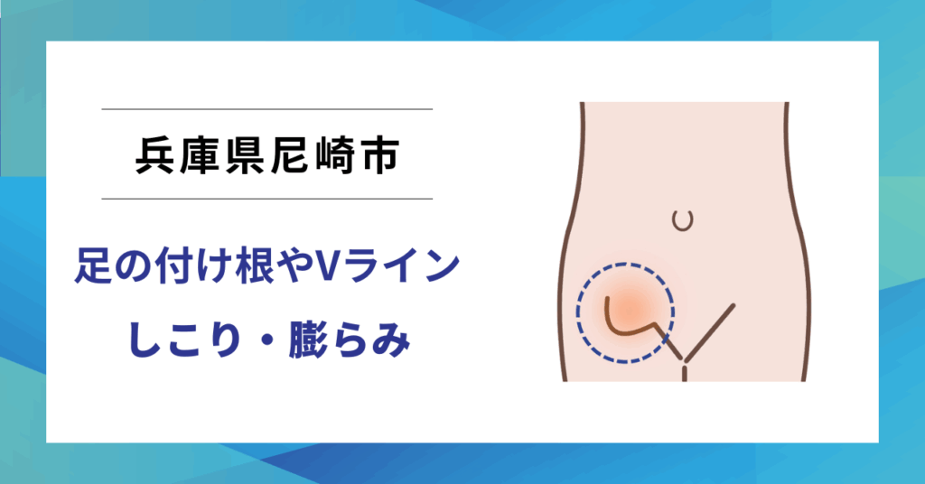 兵庫県尼崎市で鼠径ヘルニア（脱腸）の専門治療なら