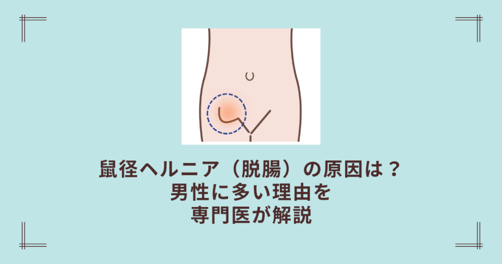 鼠径ヘルニア（脱腸）の原因は？男性に多い理由を専門医が解説