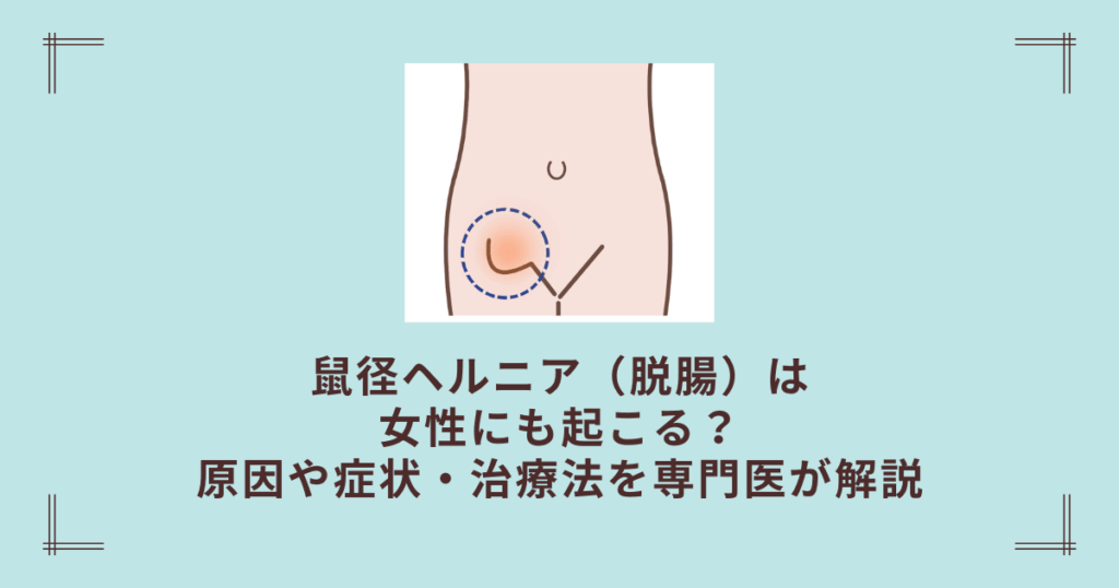 鼠径ヘルニア（脱腸）は女性にも起こる？原因や症状・治療法を専門医が解説