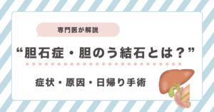 胆石症・胆のう結石とは？症状・原因・日帰り手術を大阪の専門医が解説