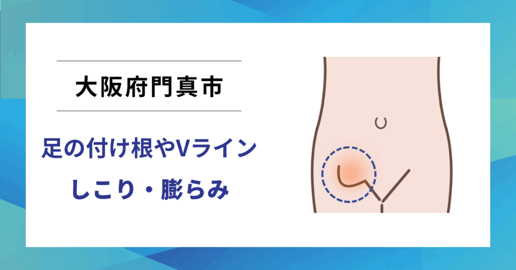 大阪府門真市で鼠径ヘルニア（脱腸）の専門治療なら