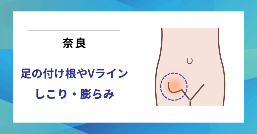 奈良で鼠径ヘルニア（脱腸）の専門治療なら