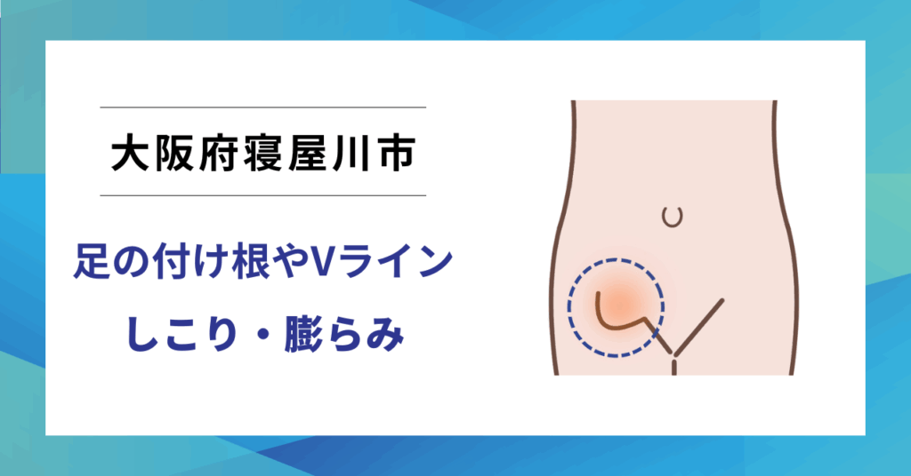 大阪府寝屋川市で鼠径ヘルニア（脱腸）の専門治療なら