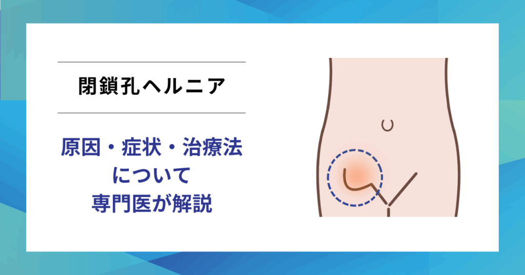 閉鎖孔ヘルニアとは？高齢女性に多いまれな脱腸を解説