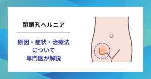 記事のサムネイル