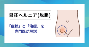 【2025年最新】鼠径ヘルニア（脱腸）の症状・写真・治療法・再発までを専門医がわかりやすく解説-日帰り手術対応-