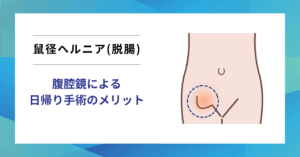 記事のサムネイル