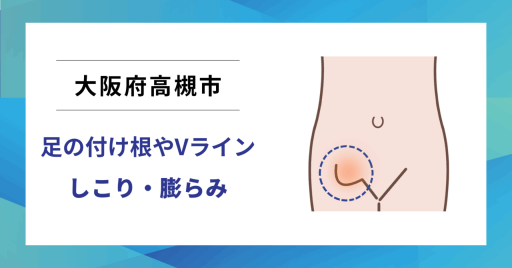 大阪府高槻市で鼠径ヘルニア（脱腸）の専門治療なら