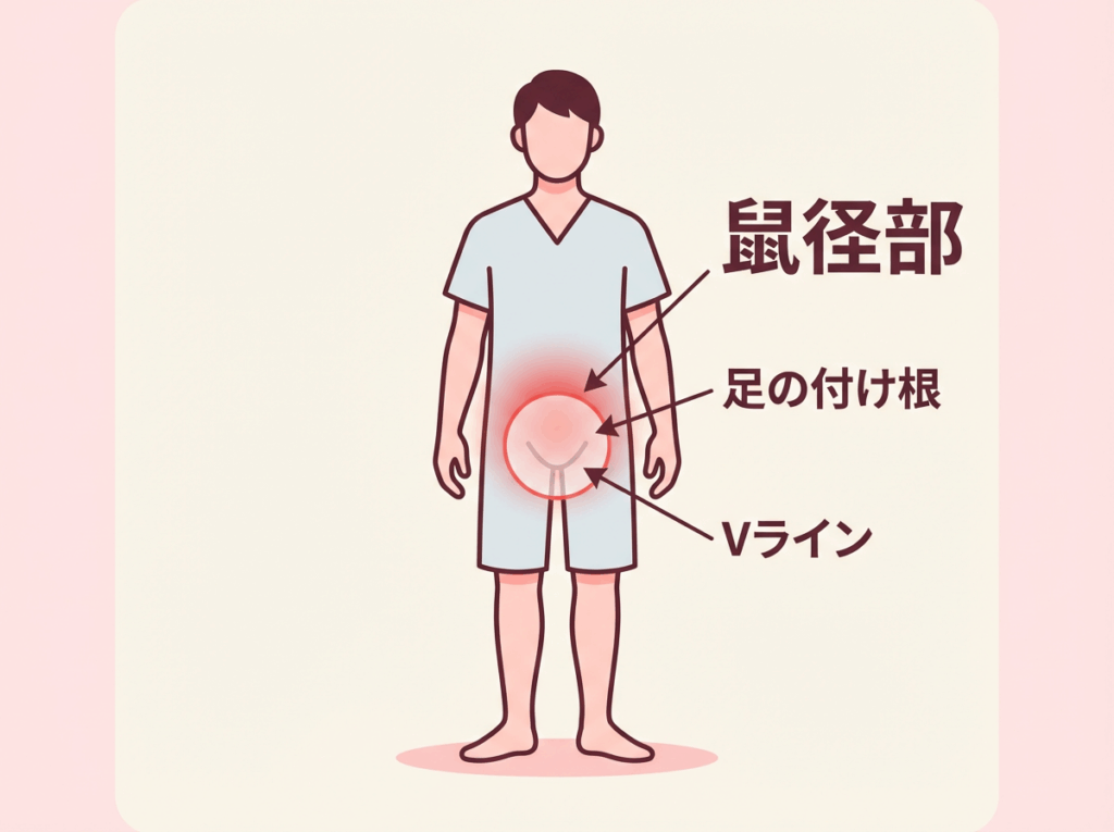 鼠径部(足の付け根・Vライン)の位置を示すイラスト。太ももの内側の付け根部分が鼠径部です。