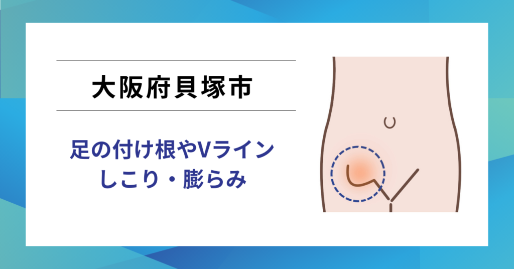 貝塚市で鼠径ヘルニア・脱腸にお悩みなら