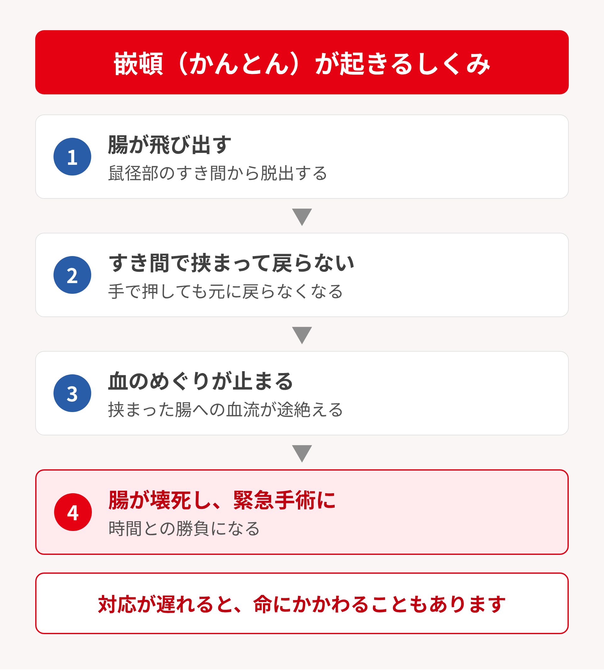 嵌頓の仕組み