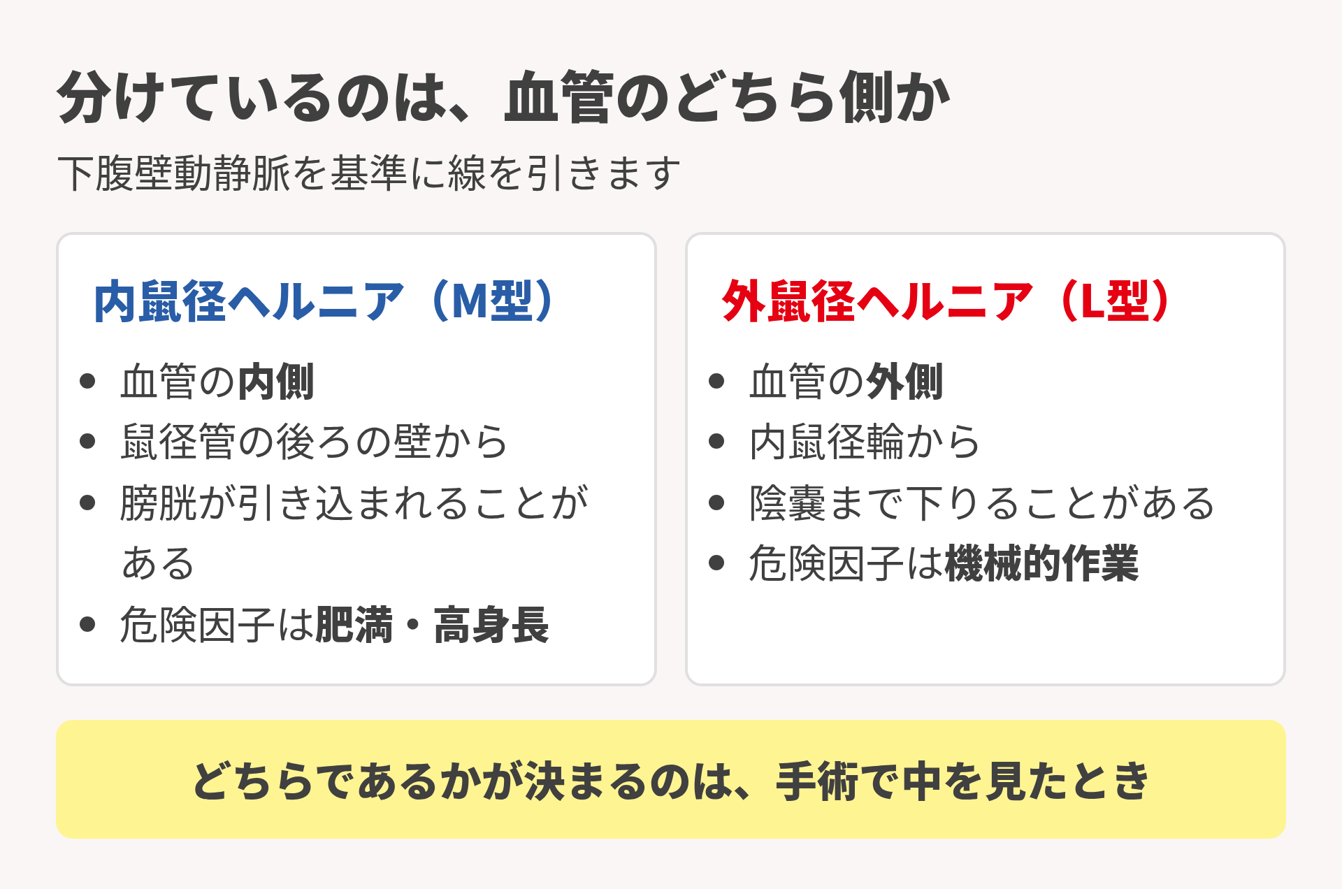 外鼠径ヘルニアと内鼠径ヘルニアの違い