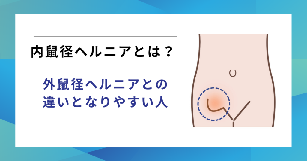 内鼠径ヘルニアとは？