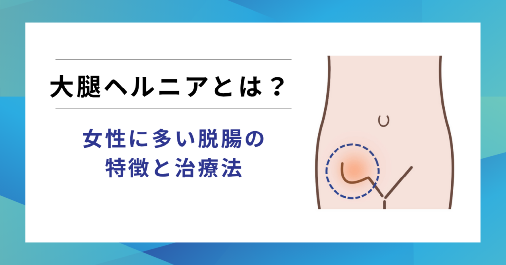 大腿ヘルニアとは？