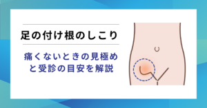 足の付け根のしこりと鼠径ヘルニア(脱腸)