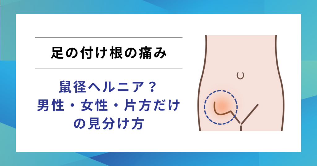 足の付け根の痛みは鼠径ヘルニア(脱腸)？