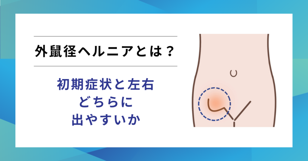 外鼠径ヘルニアとは？