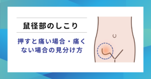鼠径部のしこり痛みと鼠径ヘルニア(脱腸)