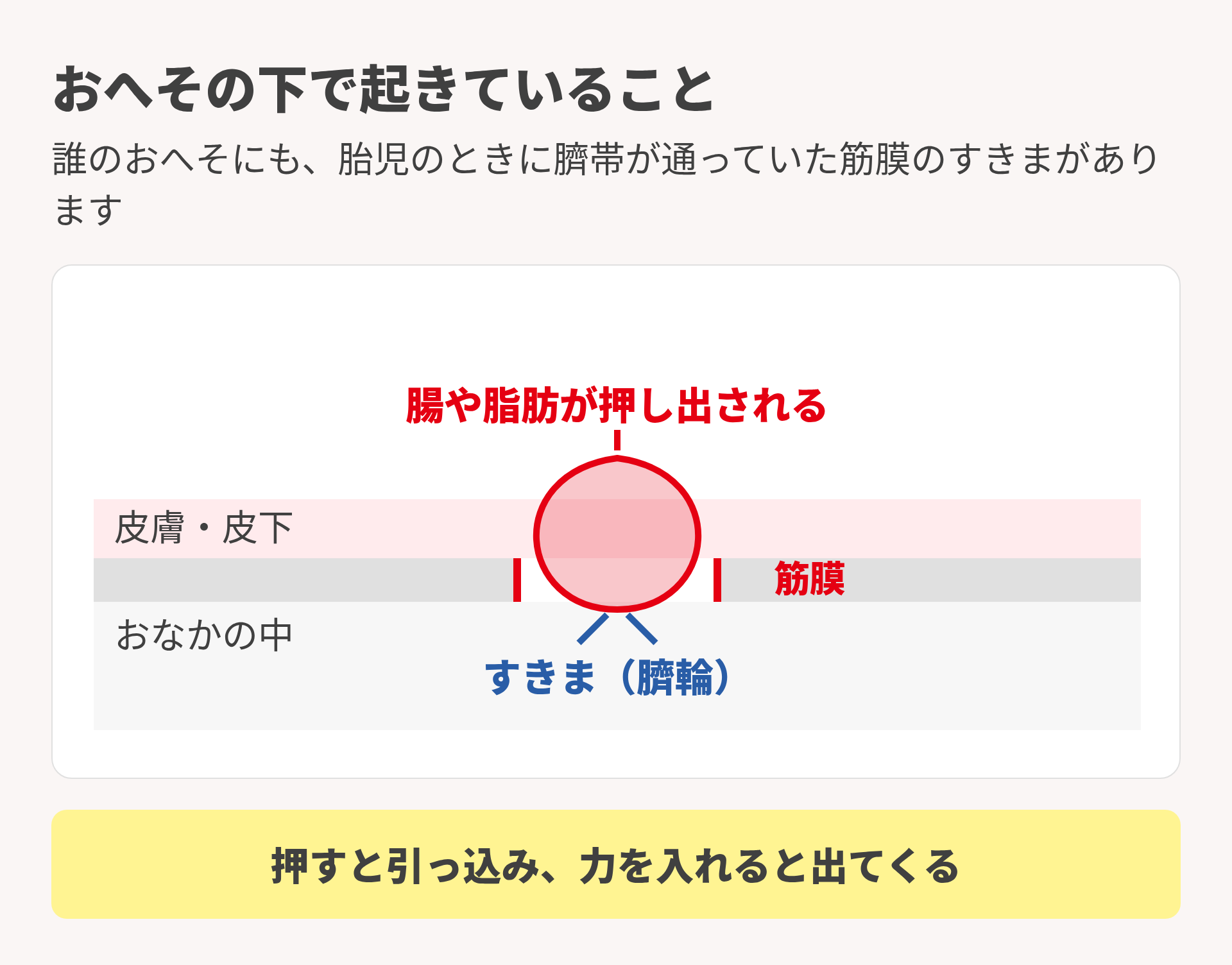 でべその仕組み