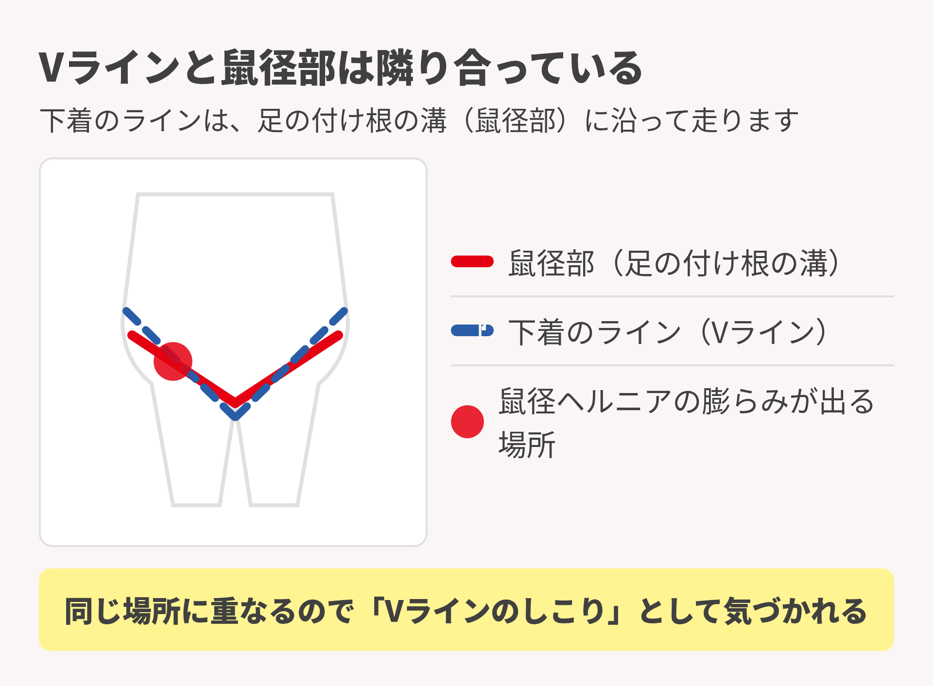 Vラインと鼠径部の位置関係