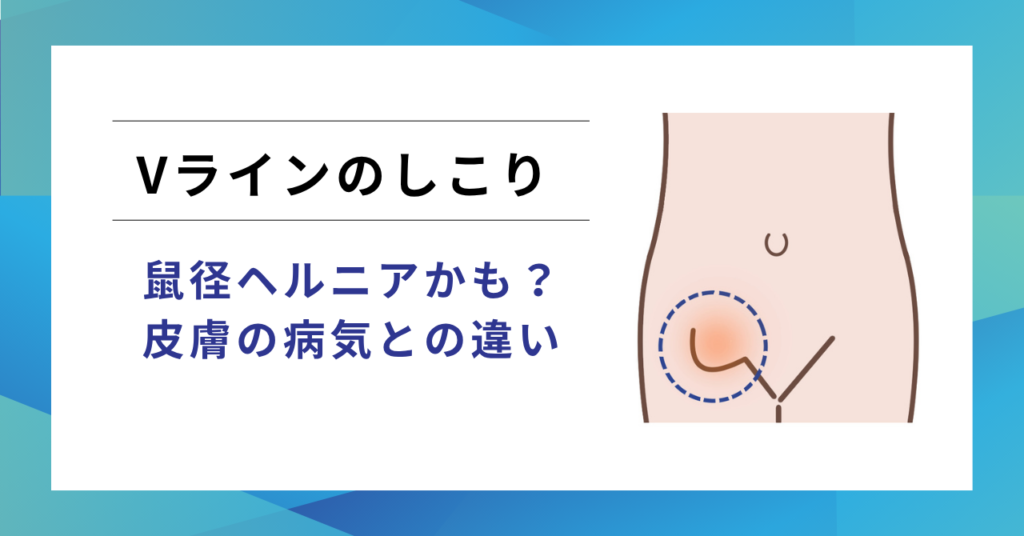 Vラインのしこりと鼠径ヘルニア(脱腸)